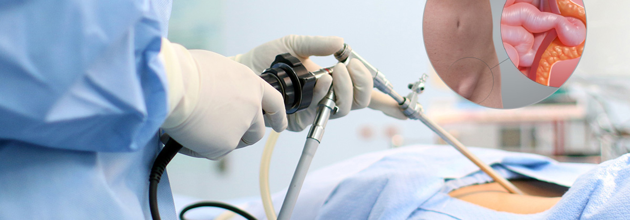 Mini-laparoskopická operácia hernie pruhu poliklinika frais