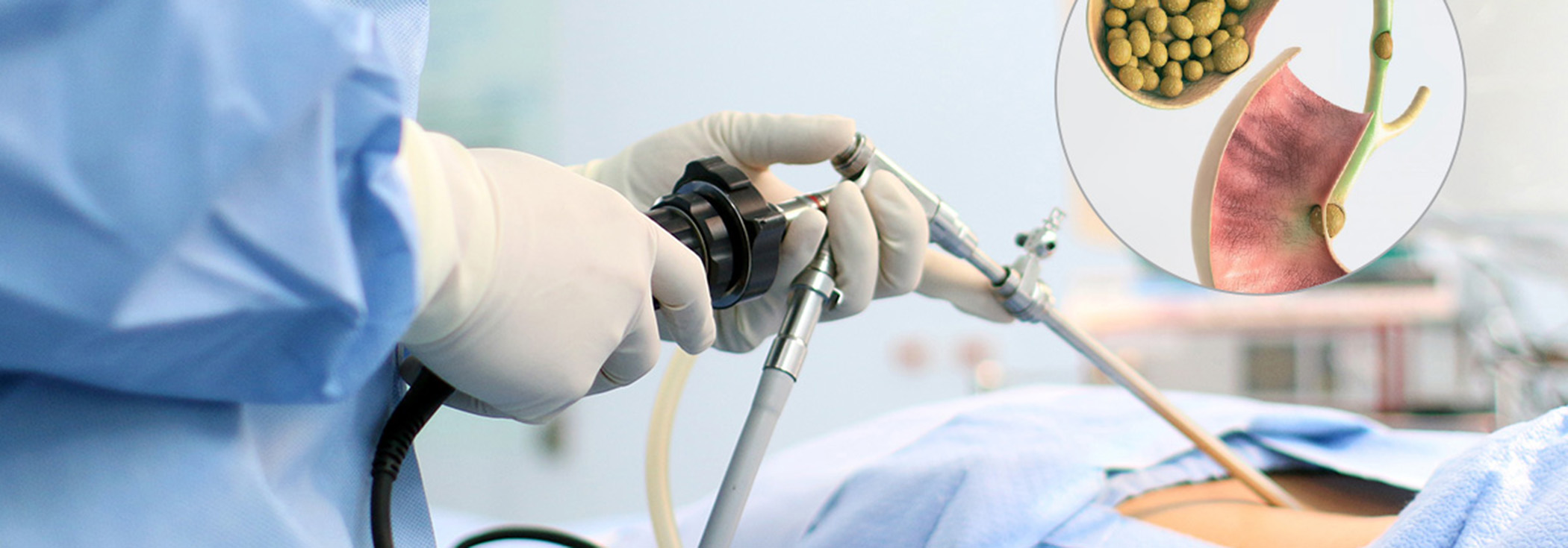 Mini-laparoskopická operácia žlčníka cholecystektómia poliklinika Frais
